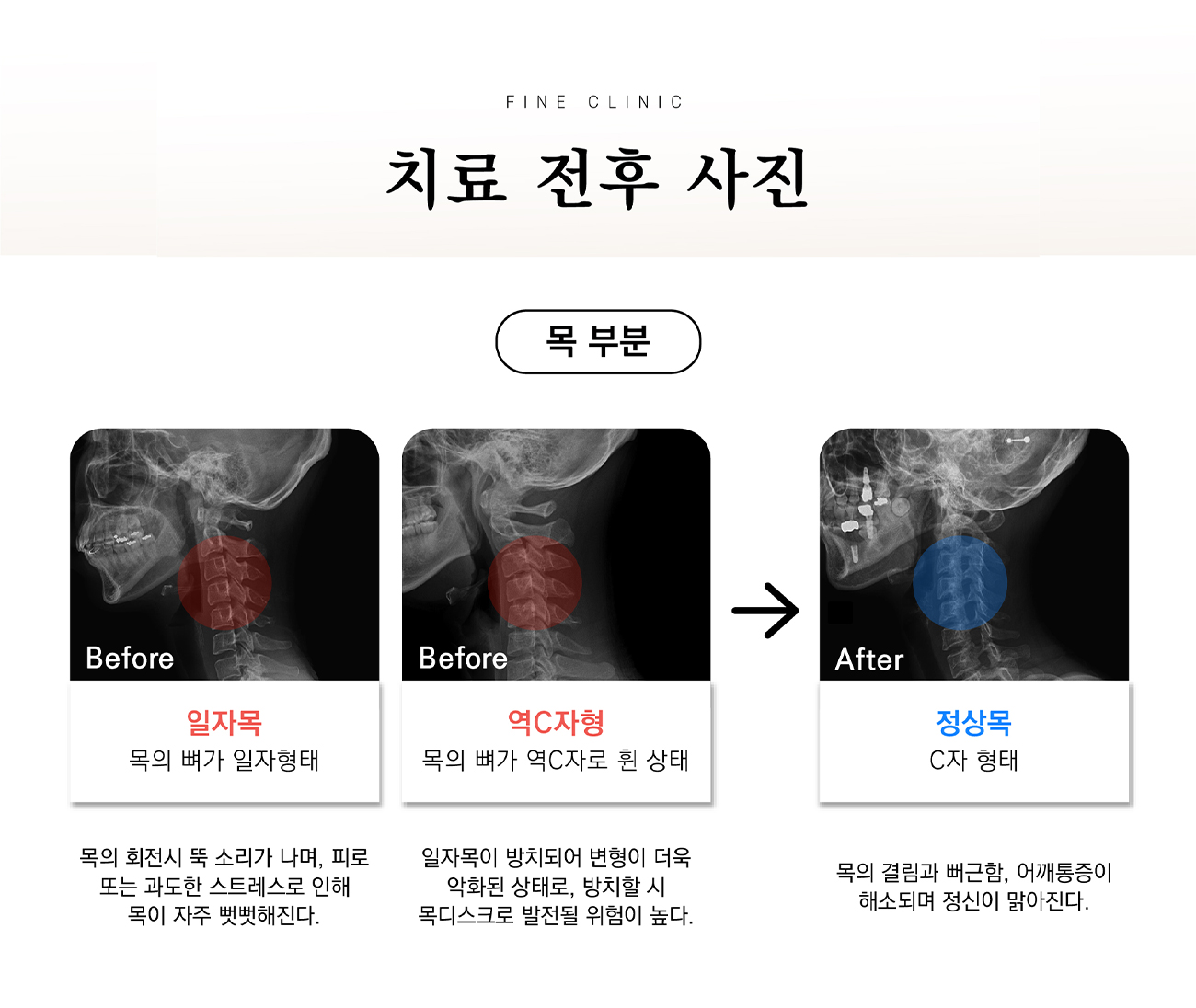 상세내용