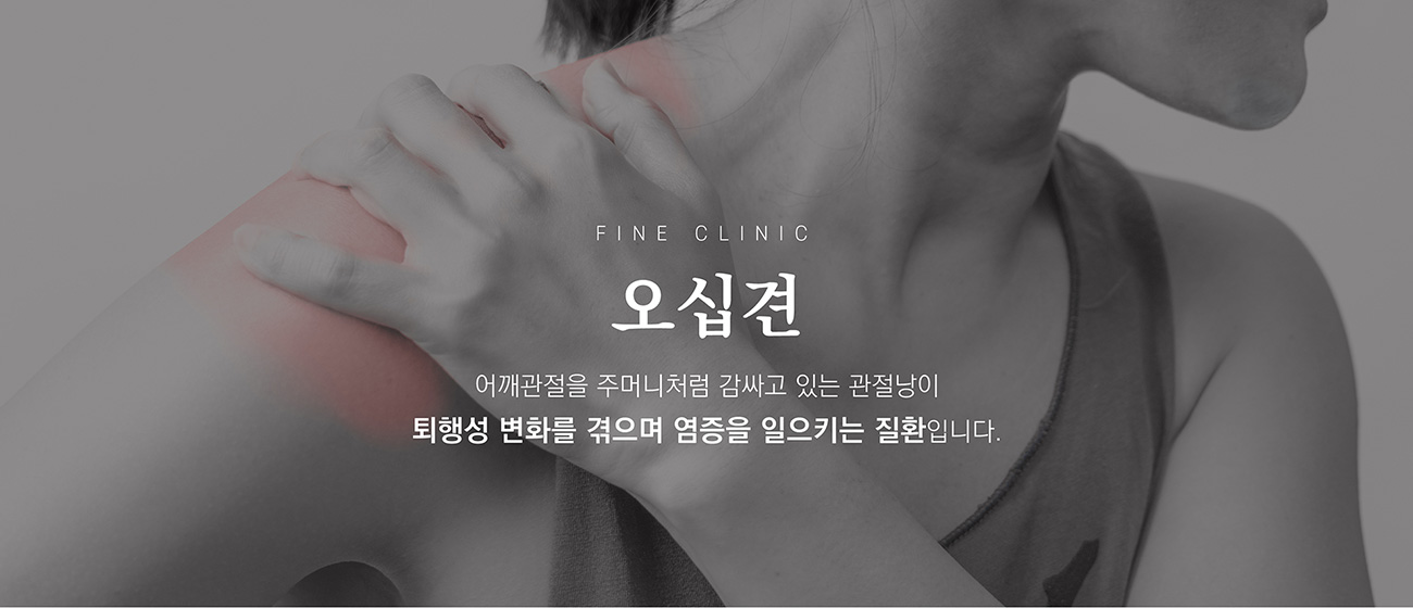 키비주얼