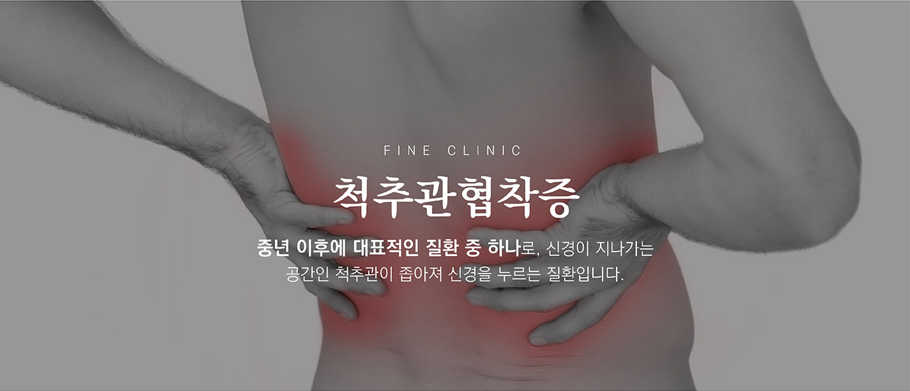 키비주얼