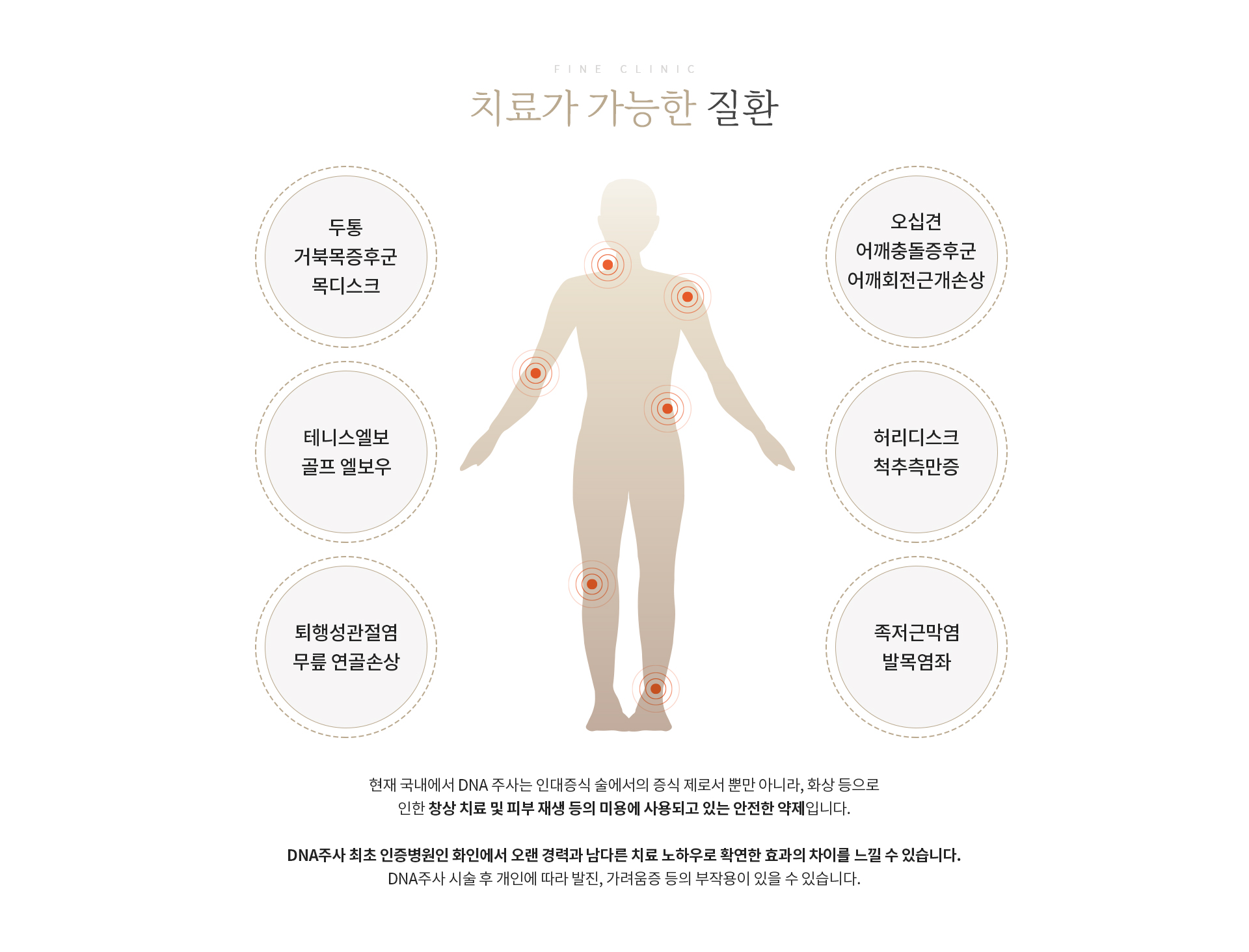 DNA주사 치료가능한질환