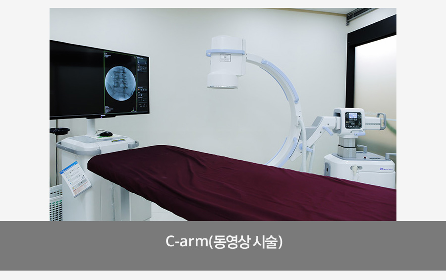 C-arm(동영상 시술)